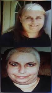 Anything I can use to get psoriasis under control I am of my biological  drug about two months now it's too high risk for me I'd rather find a  natural way im