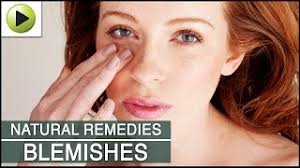 Zinc is a common ingredient used for the treatment of acne vulgaris (1). Skin Care Clearing Skin Blemishes Natural Ayurvedic Home Remedies Youtube