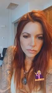 So many messages to show you all my huge swollen lips😂 Thank you to @ eden.fox.aesthetics for having me in