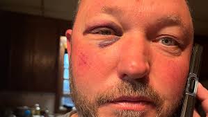 Fundraiser for Ashley Brown by Rita Brooks Brinegar : Ricky's Surgery: A  Path to Recovery