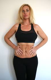 Stimulus deal before election 'would be difficult'. Big Brother S Josie Gibson Shares Gruesome Photo Of A Chunk Of Her Belly Fat Surgically Removed In Tummy Tuck