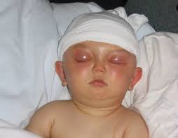 The minute they take him away, you're scared as hell': Cranial surgery as  infant doesn't keep QND's Lavery from game he loves