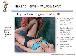 Image result for Hip Exam