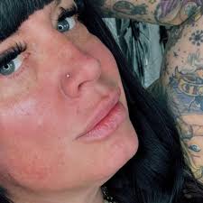 Fundraiser by Heather Silvis : Stand with Heather Silvis: Fighting Cancer  Together