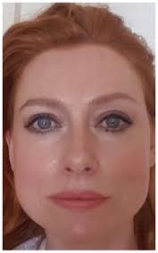 My face yoga experience: Sandra's story