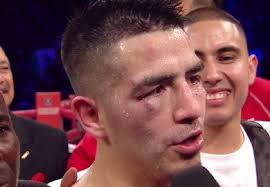 Rios Vs. Alvarado: Brandon Takes A Ton Of Punishment In Winning; Pacquiao  Could Be Next