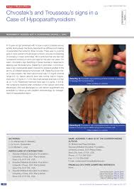 Chvostek sign is a clinical indication of hypocalcemia. Pdf Chvostek S And Trousseau S Signs In A Case Of Hypoparathyroidism