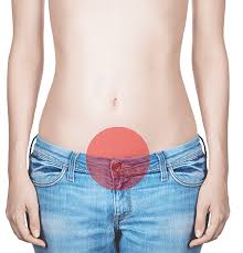 Extent of operation depends on uterus size, nodosity size and woman age. Myome Frauenarztpraxis Herrenhausen Hannover