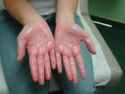 Sweaty hands don't dry up on their own, so you'll have to wash them more often than most people do in order to keep them dry. Why Do Some People Have Sweaty Hands All The Time Quora