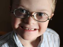 Down Syndrome Awareness Month is opportunity to spread the word about  disorder