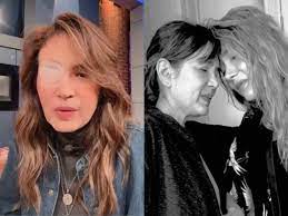 Yolanda Andrade desata preocupación luego de recibir doloroso tratamiento |  Univision Famosos | Univision