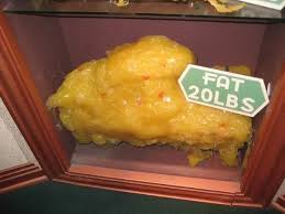 What Does 40 Pounds Of Fat Look Like Quora