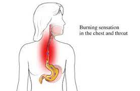 Symptoms Of Gastroesophageal Reflux Disease Gerd Cancer Care Of Western New York