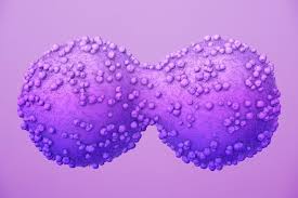 Cancer refers to any one of a large number of diseases characterized by the development of cancer often has the ability to spread throughout your body. How Cancer Cells Fuel Their Growth Mit News Massachusetts Institute Of Technology