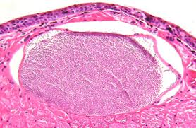 Image result for Lankesteria