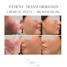 Beauty Lounge Co., LLC