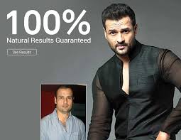 Ongoing costs, when they were mentioned, ranged from $1500 to $1820 per year. Hair Loss Treatment Best Hair Fall Treatment For Men Women Dhi India
