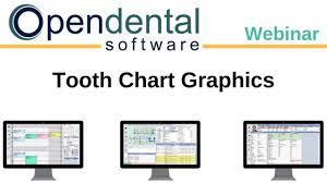 Open Dental Webinar Tooth Chart Graphics