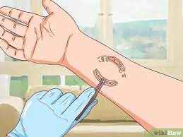 Cooking injuries, curling irons and liquid scalds are common causes of burns. How To Treat A Human Bite 15 Steps With Pictures Wikihow