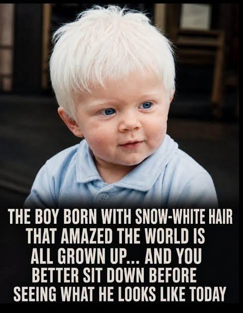 What happened to the boy born with snow-white hair?