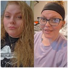 I did CS 4 weeks ago. When should I start taking cold drink please.