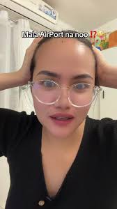 Mataas na Hairline? Subukan ang Hosoku Minoxidil!