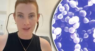 Doctor's warning over 'nasty' infection