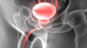 Blasenschwache Beim Mann Oft Ist Die Prostata Schuld An Inkontinenz