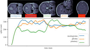 Tni has performed more than 6,000,000 medical imaging tests in ontario since 1982 and has provided service to more than 5,000 ontario doctors. Deep Medical Image Analysis With Representation Learning And Neuromorphic Computing Interface Focus