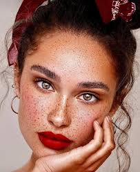 Why are freckles considered to be a beauty flaw?