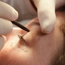 Aesthetic Plastic Surgery Fact Sheets Yale Medicine