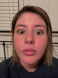 This might be an odd question. Can you use relief topically