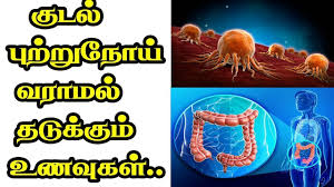 Below are some of the symptoms of skin cancer, but it's important to recognize that each person and every skin cancer is different. à®µà®¯ à®± à®± à®ª à®± à®± à®¨ à®¯ à®µà®° à®µà®¤à®± à® à®© à®à®± à® à®± à®à®³ à®à®µ à®à®³ à®¤ à®© Stomach Cancer Symptoms Causes In Tamil Youtube