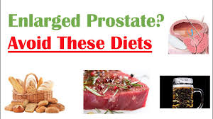Prostate cancer is one of the most common types of cancer diagnosed in men. Foods To Avoid With Enlarged Prostate Reduce Symptoms And Risk Of Prostate Cancer Youtube