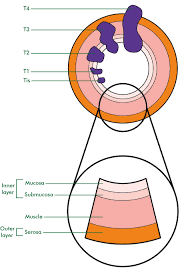 staging and grading of colon cancer information and