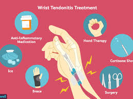 Tendons transmit the mechanical force of muscle contraction to the bones. Wrist Tendonitis Signs Causes And Treatments