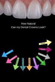 Is it painful to have a crown put on your tooth? Pin On A