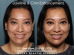 The Pink Party by @evolus 💕was such a fun night spent with my colleagues  Gina Berger and Luke Levin learning and sharing all things Jeuveau!! Loved  catching up with Erika Barry @injectorbunny