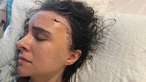 Fundraiser by Pamela Lacy : Help Laura Howard's recovery