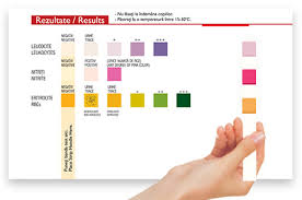 Uractiv Test Uractiv