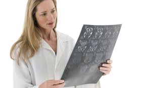 Il est extrêmement difficile de savoir au départ comment la sclérose en plaques va évoluer. Sclerose En Plaques Vrai Faux Sur Les Idees Recues Actualites Sante Sclerose En Plaques Vrai Faux Sur Les Idees Recues
