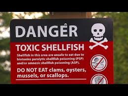 Image result for Amnesic Shellfish Poisoning