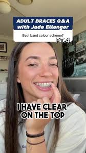 Wondering what colour bands to get with your braces as an adult? #ad  #sponsored #brisbane #braces #adultbraces
