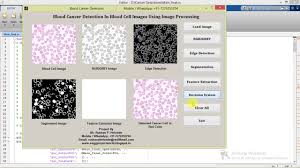 Yes,blood smear test can tell you about blood cancers.blood is taken from vein,tip of finger,or from bones.it is spread on glass slide and stained with dyes and then dried and seen under microscopes.you may detect blood cancer if presentfor other cancers you cannot directly detect cancer cells in the. Source Code In Blood Cancer Bitlasopa