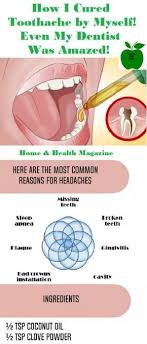 Pin On Health And Fitness Toothache refers to pain in and around the teeth and jaws and is one of the most common symptoms of dental caries or tooth decay.