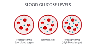 Diabetes And Hyperglycemia Hyperglycemia Symptoms And Causes