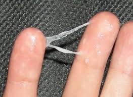 Check spelling or type a new query. Third Trimester And You See Whitish Discharge Is It Normal New Kids Center