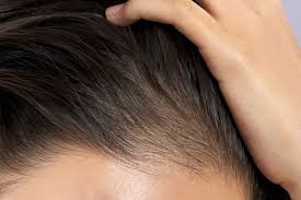 Hand sew the tears with a sewing needle and thread. Baby Hair Or Breakage What S The Difference Prose Hair