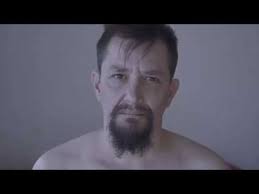 Efter ti års ventetid fik Daniel endelig fjernet sin bryster