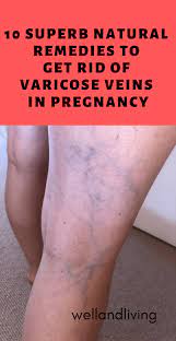 Pin On Natural Remedies